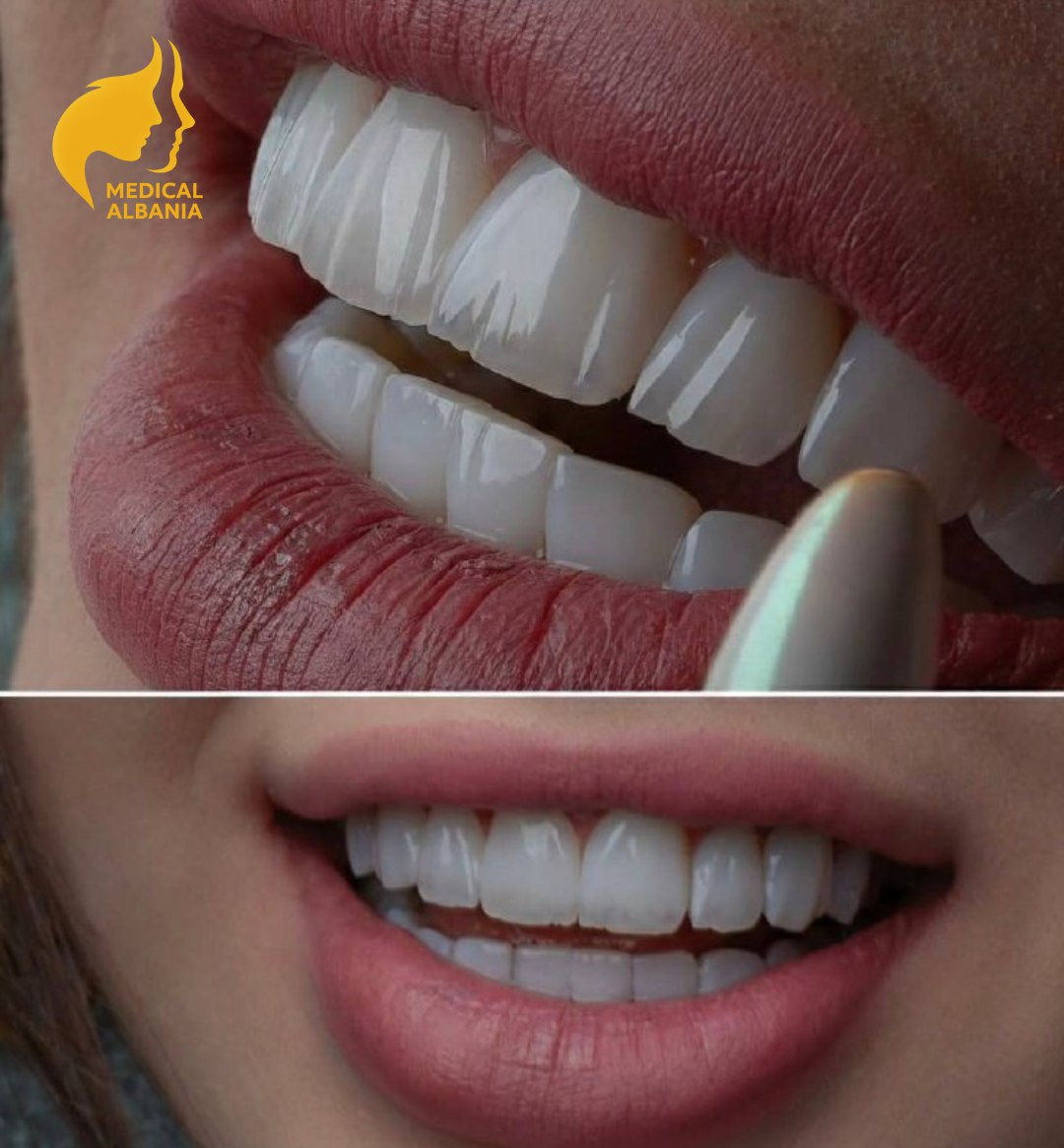 Antes y Despues - Estetica